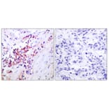 Immunohistochemistry - Anti-NF-kappaB p65 (phospho Ser468) Antibody (A7170) - Antibodies.com