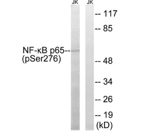 Western Blot - Anti-NF-kappaB p65 (phospho Ser276) Antibody (A7169) - Antibodies.com