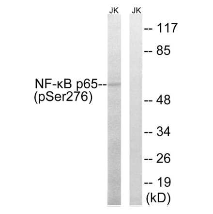 Western Blot - Anti-NF-kappaB p65 (phospho Ser276) Antibody (A7169) - Antibodies.com