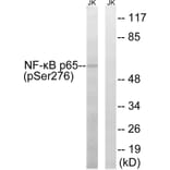 Western Blot - Anti-NF-kappaB p65 (phospho Ser276) Antibody (A7169) - Antibodies.com