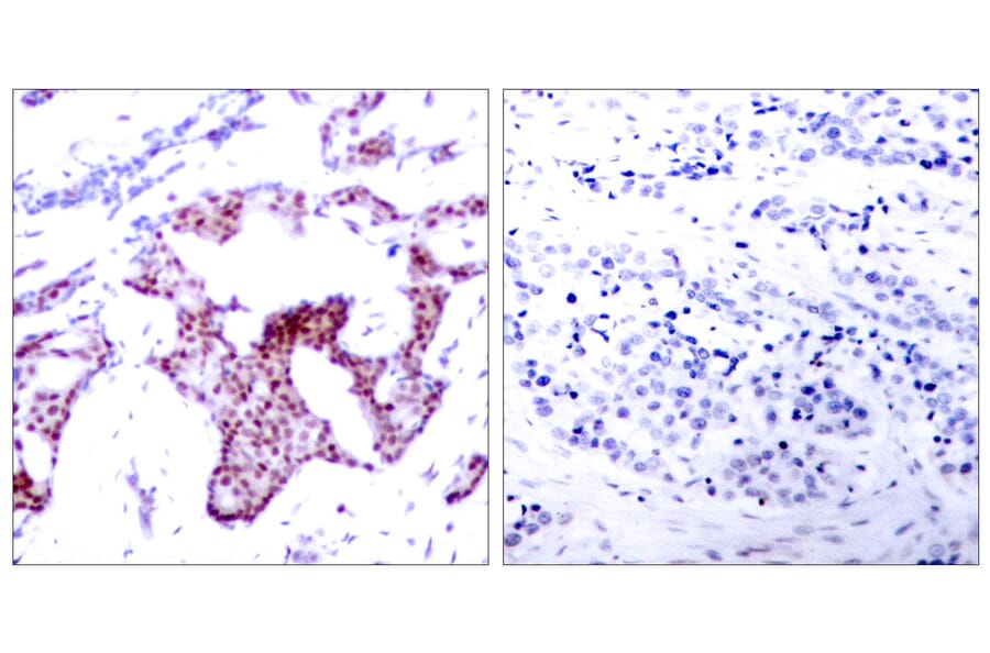 Immunohistochemistry - Anti-NF-kappaB p65 (phospho Ser276) Antibody (A7169) - Antibodies.com