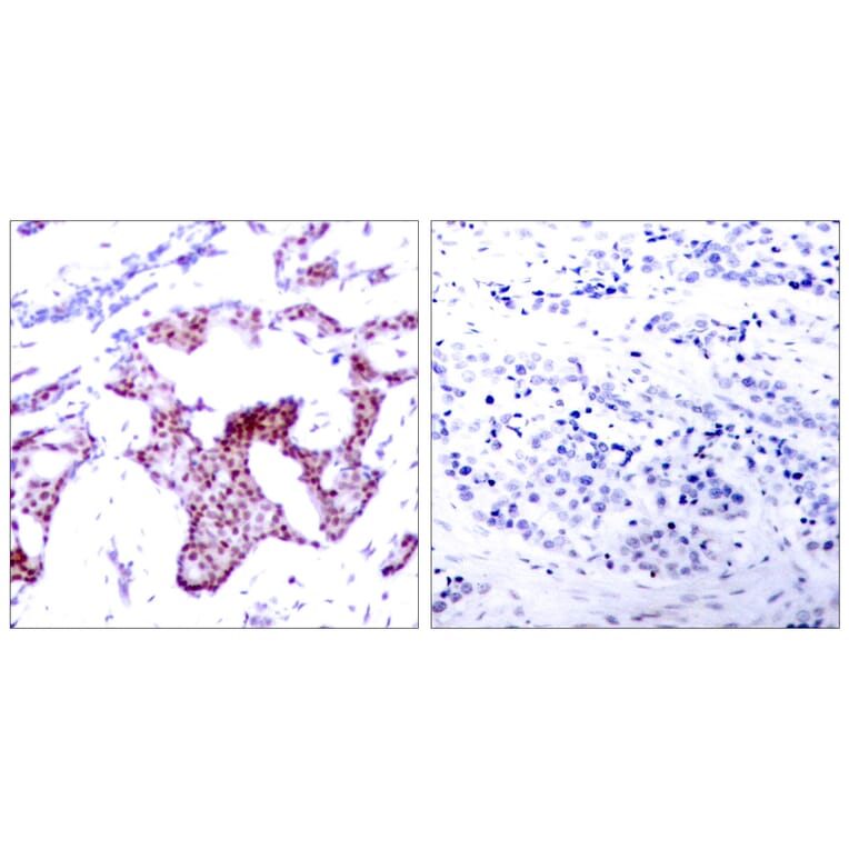 Immunohistochemistry - Anti-NF-kappaB p65 (phospho Ser276) Antibody (A7169) - Antibodies.com