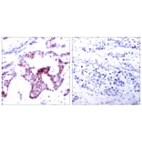 Immunohistochemistry - Anti-NF-kappaB p65 (phospho Ser276) Antibody (A7169) - Antibodies.com