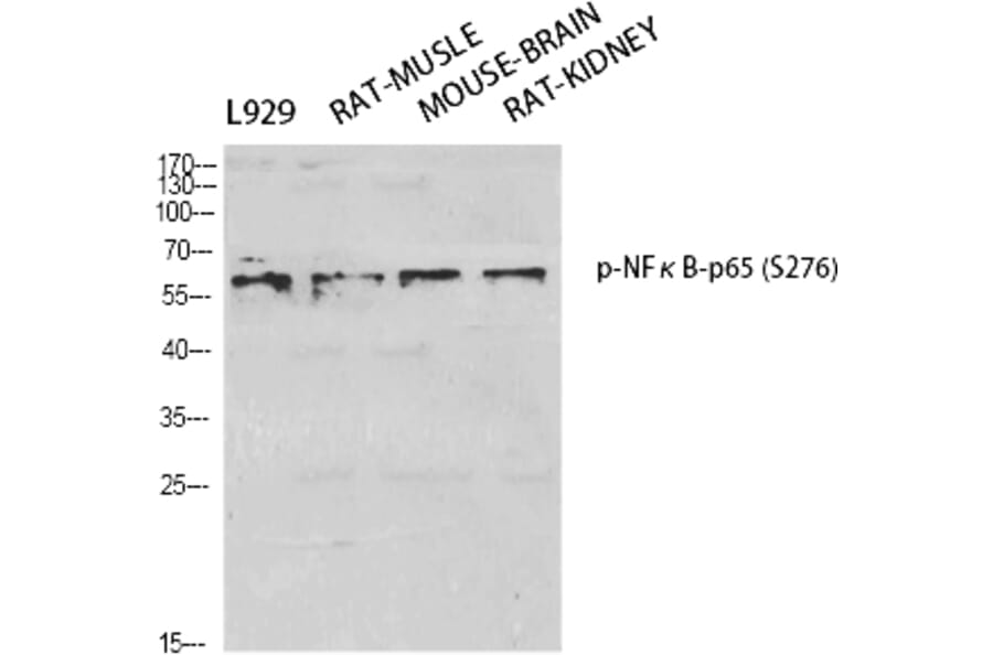 Western Blot - Anti-NF-kappaB p65 (phospho Ser276) Antibody (A7169) - Antibodies.com