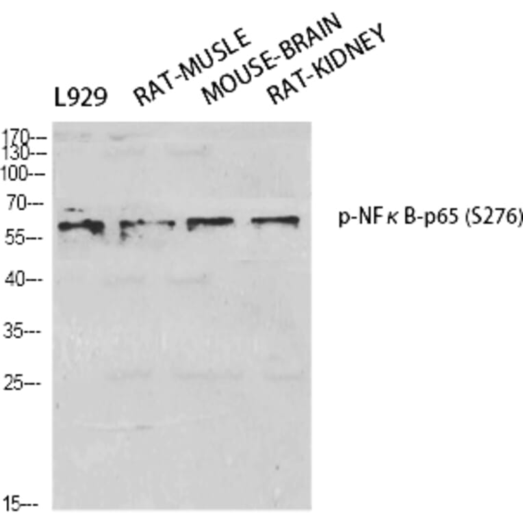 Western Blot - Anti-NF-kappaB p65 (phospho Ser276) Antibody (A7169) - Antibodies.com