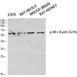 Western Blot - Anti-NF-kappaB p65 (phospho Ser276) Antibody (A7169) - Antibodies.com