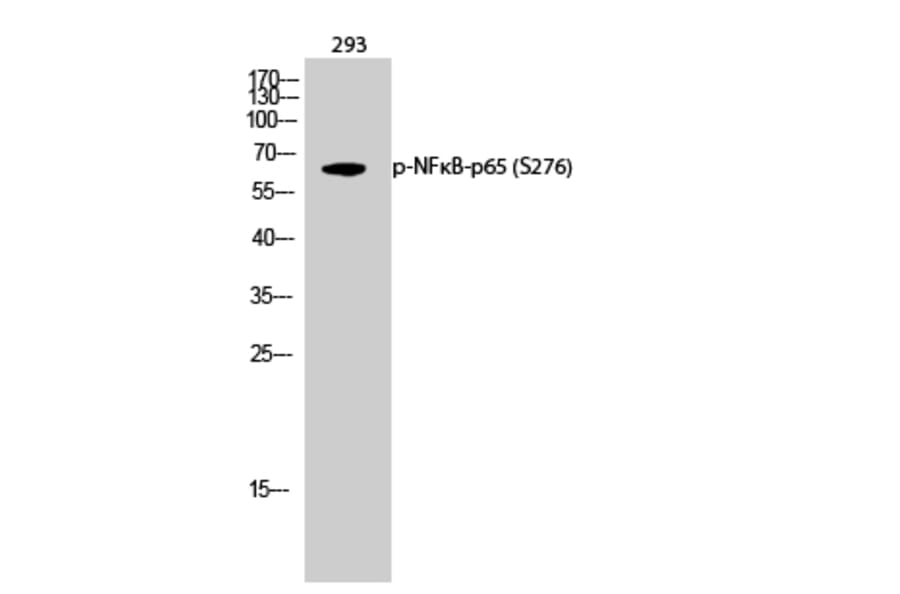 Western Blot - Anti-NF-kappaB p65 (phospho Ser276) Antibody (A7169) - Antibodies.com