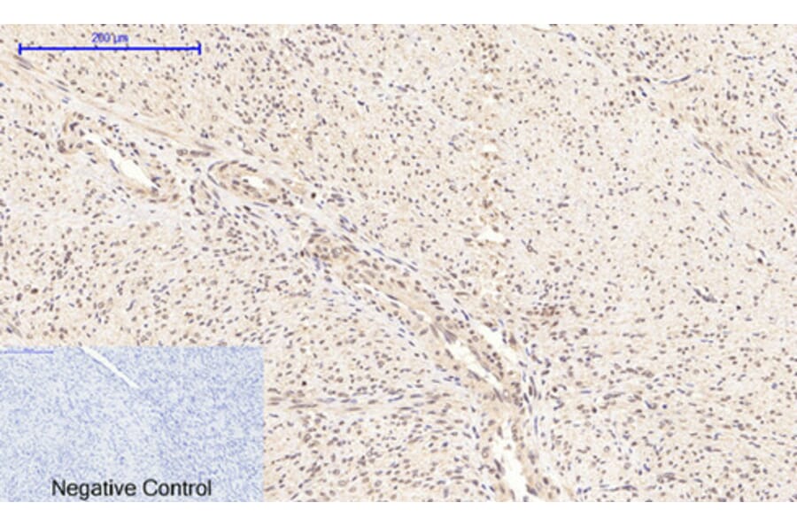 Immunohistochemistry - Anti-NF-kappaB p65 (phospho Ser276) Antibody (A7169) - Antibodies.com