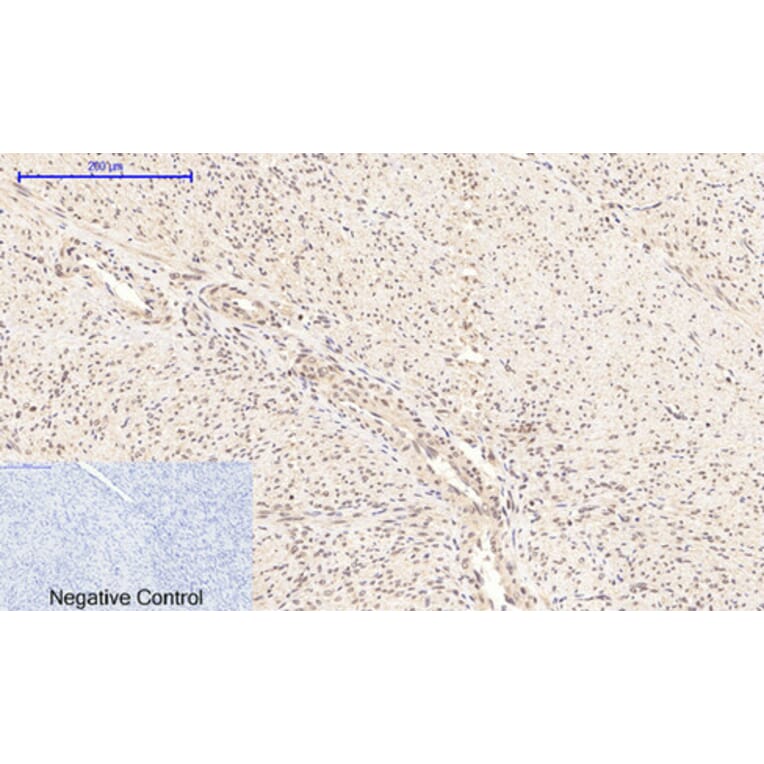 Immunohistochemistry - Anti-NF-kappaB p65 (phospho Ser276) Antibody (A7169) - Antibodies.com