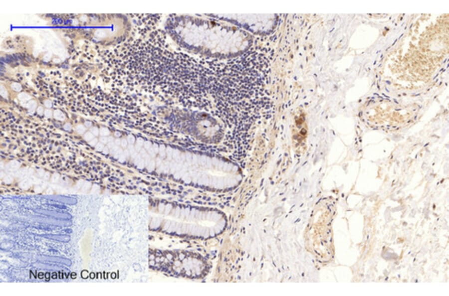 Immunohistochemistry - Anti-NF-kappaB p65 (phospho Ser276) Antibody (A7169) - Antibodies.com