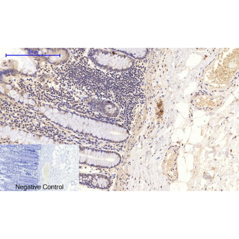 Immunohistochemistry - Anti-NF-kappaB p65 (phospho Ser276) Antibody (A7169) - Antibodies.com