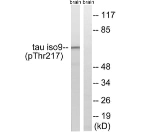 Western Blot - Anti-Tau (phospho Thr534 + Thr217) Antibody (A8068) - Antibodies.com