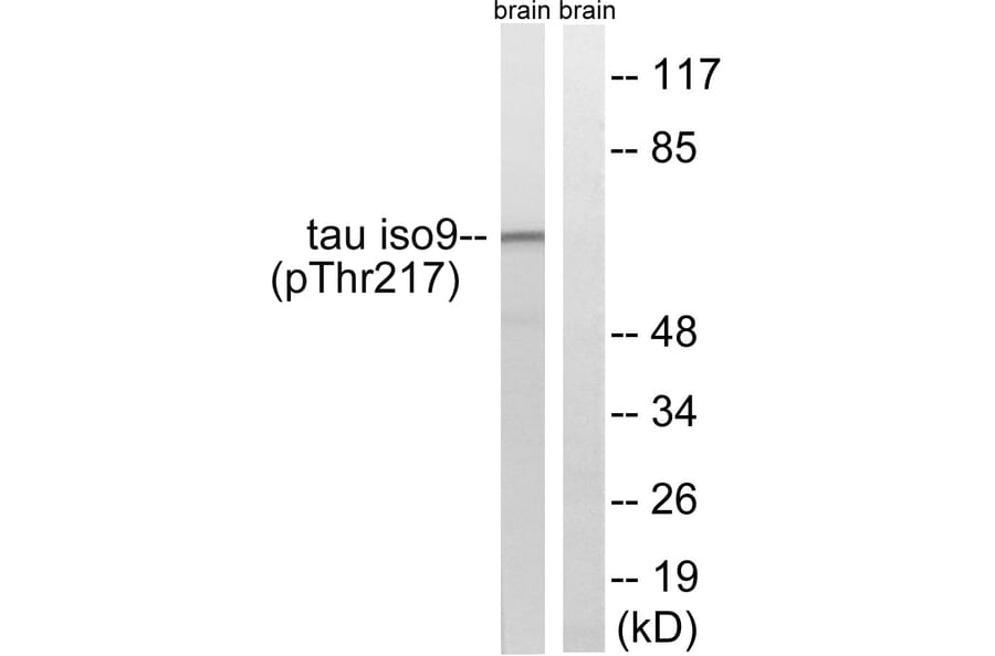 Western Blot - Anti-Tau (phospho Thr534 + Thr217) Antibody (A8068) - Antibodies.com