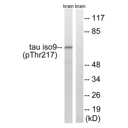 Western Blot - Anti-Tau (phospho Thr534 + Thr217) Antibody (A8068) - Antibodies.com