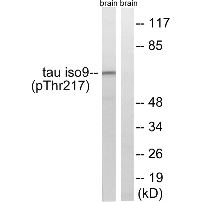 Western Blot - Anti-Tau (phospho Thr534 + Thr217) Antibody (A8068) - Antibodies.com