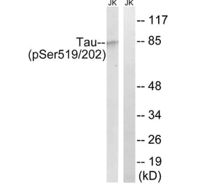Western Blot - Anti-Tau (phospho Ser519 + Ser202) Antibody (A8067) - Antibodies.com