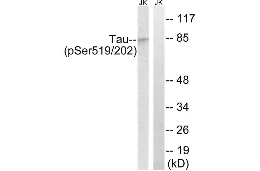 Western Blot - Anti-Tau (phospho Ser519 + Ser202) Antibody (A8067) - Antibodies.com