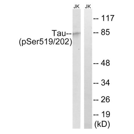 Western Blot - Anti-Tau (phospho Ser519 + Ser202) Antibody (A8067) - Antibodies.com