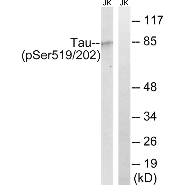 Western Blot - Anti-Tau (phospho Ser519 + Ser202) Antibody (A8067) - Antibodies.com