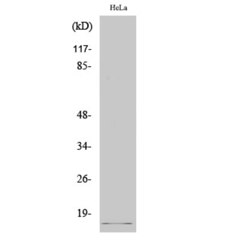 Western Blot - Anti-SUMO2 + SUMO3 (cleaved Gly93) Antibody (L0379) - Antibodies.com