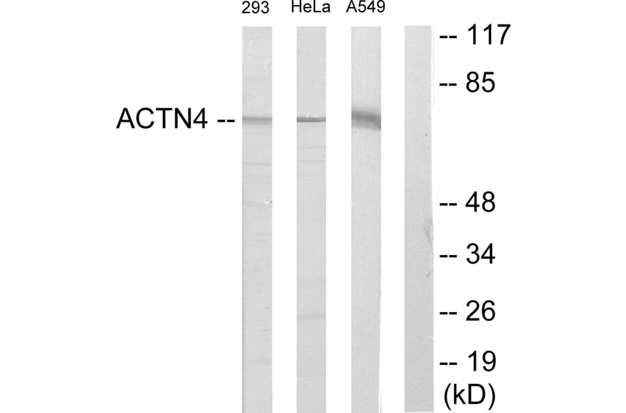 Western Blot - Anti-ACTN1 + ACTN2 + ACTN3 + ACTN4 Antibody (C12027) - Antibodies.com