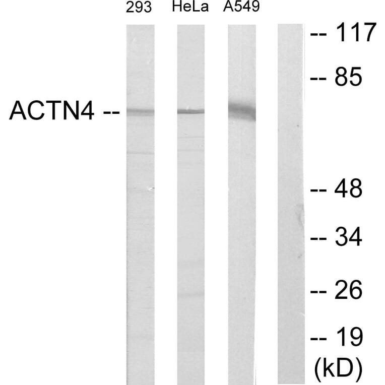 Western Blot - Anti-ACTN1 + ACTN2 + ACTN3 + ACTN4 Antibody (C12027) - Antibodies.com
