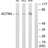 Western Blot - Anti-ACTN1 + ACTN2 + ACTN3 + ACTN4 Antibody (C12027) - Antibodies.com