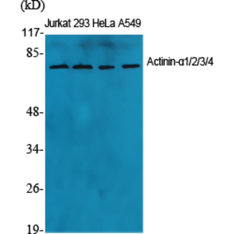 Western Blot - Anti-ACTN1 + ACTN2 + ACTN3 + ACTN4 Antibody (C12027) - Antibodies.com