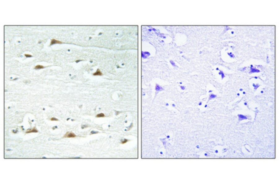 Immunohistochemistry - Anti-ACTN1 + ACTN2 + ACTN3 + ACTN4 Antibody (C12027) - Antibodies.com
