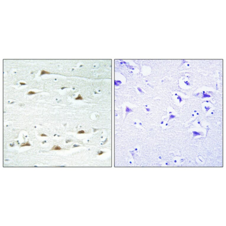Immunohistochemistry - Anti-ACTN1 + ACTN2 + ACTN3 + ACTN4 Antibody (C12027) - Antibodies.com