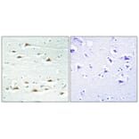 Immunohistochemistry - Anti-ACTN1 + ACTN2 + ACTN3 + ACTN4 Antibody (C12027) - Antibodies.com