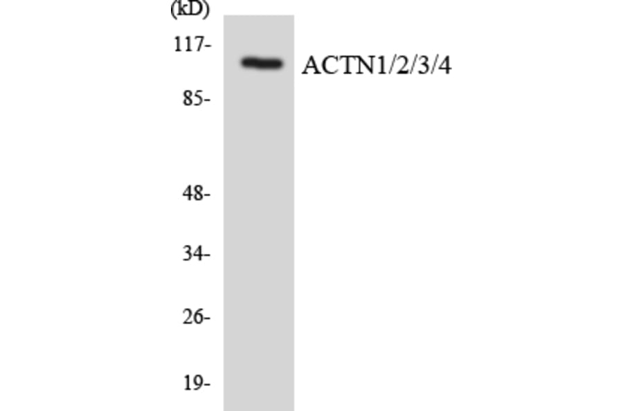 Western Blot - Anti-ACTN1 + ACTN2 + ACTN3 + ACTN4 Antibody (R12-2442) - Antibodies.com