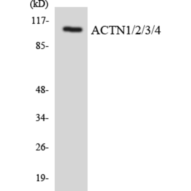 Western Blot - Anti-ACTN1 + ACTN2 + ACTN3 + ACTN4 Antibody (R12-2442) - Antibodies.com