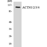 Western Blot - Anti-ACTN1 + ACTN2 + ACTN3 + ACTN4 Antibody (R12-2442) - Antibodies.com