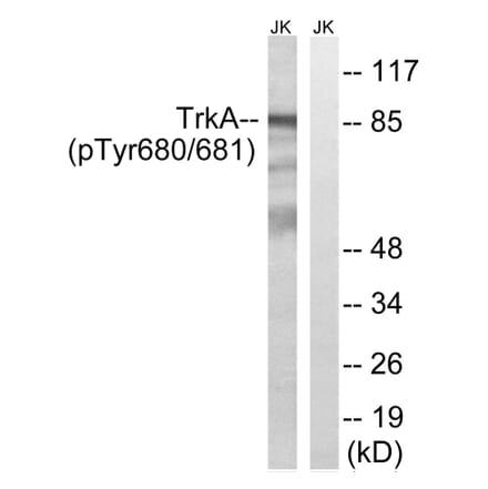 Western Blot - Anti-Trk A (phospho Tyr680+Tyr681) Antibody (A8071) - Antibodies.com