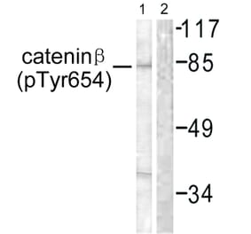 Western Blot - Anti-Catenin-beta (phospho Tyr654) Antibody (A0837) - Antibodies.com
