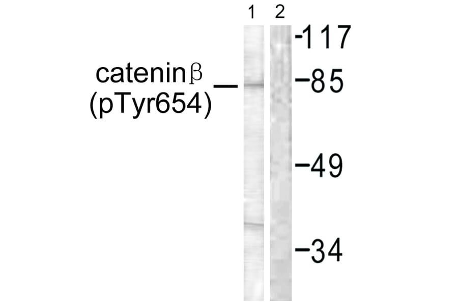 Western Blot - Anti-Catenin-beta (phospho Tyr654) Antibody (A0837) - Antibodies.com