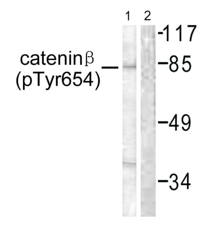 Western Blot - Anti-Catenin-beta (phospho Tyr654) Antibody (A0837) - Antibodies.com