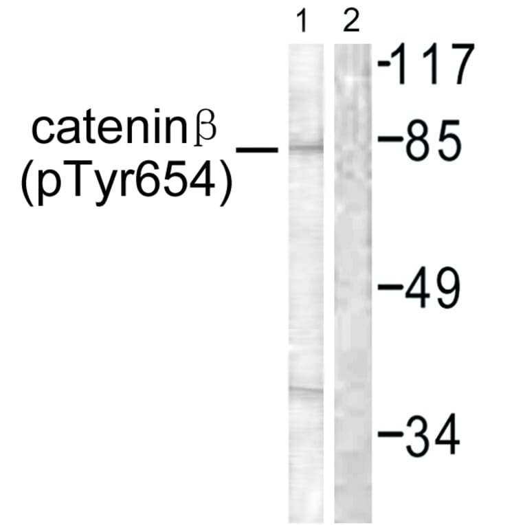 Western Blot - Anti-Catenin-beta (phospho Tyr654) Antibody (A0837) - Antibodies.com