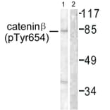 Western Blot - Anti-Catenin-beta (phospho Tyr654) Antibody (A0837) - Antibodies.com