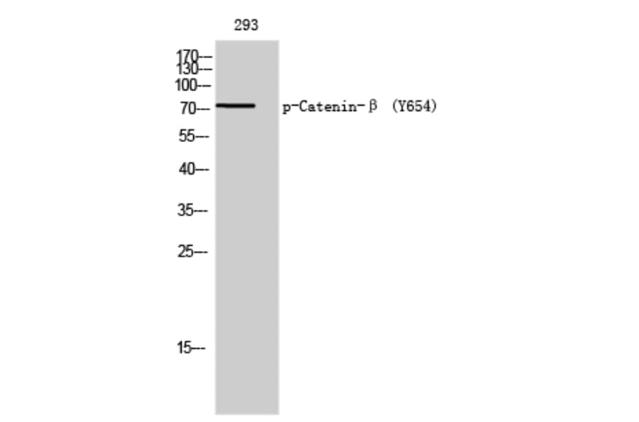 Western Blot - Anti-Catenin-beta (phospho Tyr654) Antibody (A0837) - Antibodies.com