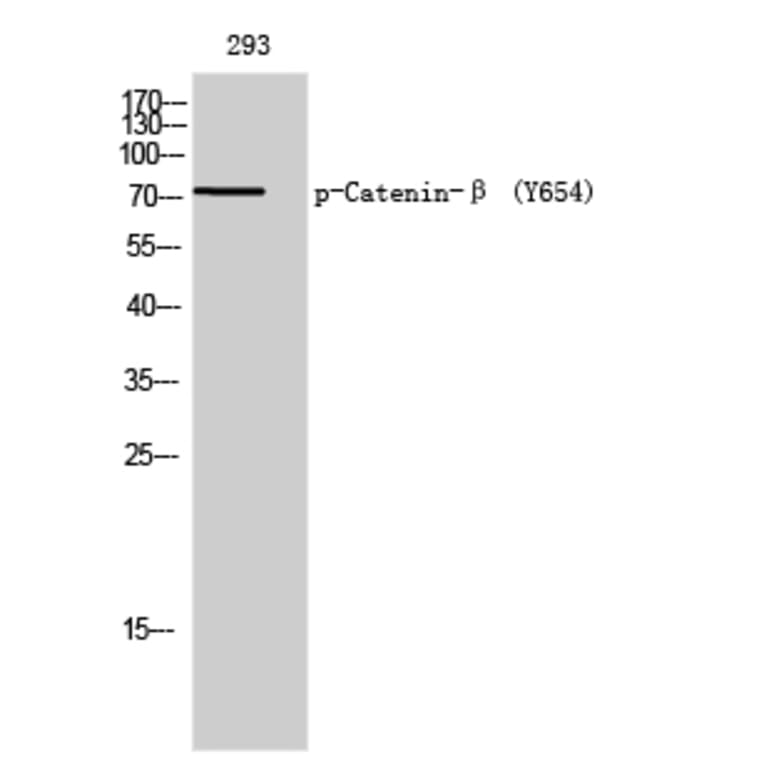 Western Blot - Anti-Catenin-beta (phospho Tyr654) Antibody (A0837) - Antibodies.com