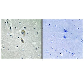 Immunohistochemistry - Anti-IL-1R alpha (phospho Tyr496) Antibody (A1059) - Antibodies.com