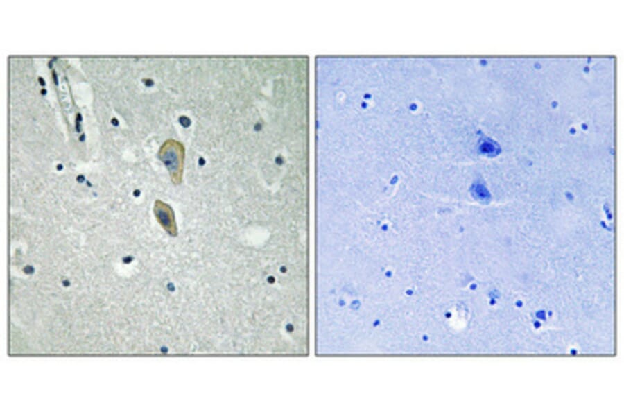 Immunohistochemistry - Anti-IL-1R alpha (phospho Tyr496) Antibody (A1059) - Antibodies.com