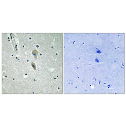 Immunohistochemistry - Anti-IL-1R alpha (phospho Tyr496) Antibody (A1059) - Antibodies.com