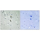 Immunohistochemistry - Anti-IL-1R alpha (phospho Tyr496) Antibody (A1059) - Antibodies.com