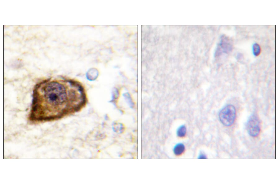 Immunohistochemistry - Anti-PDGFR beta (phospho Tyr1021) Antibody (A0971) - Antibodies.com