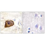 Immunohistochemistry - Anti-PDGFR beta (phospho Tyr1021) Antibody (A0971) - Antibodies.com