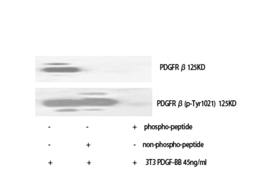 Western Blot - Anti-PDGFR beta (phospho Tyr1021) Antibody (A0971) - Antibodies.com