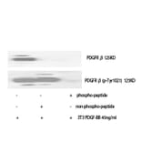 Western Blot - Anti-PDGFR beta (phospho Tyr1021) Antibody (A0971) - Antibodies.com